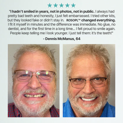 Today's Special Offer | 😀Smile with Confidence|Buy 2 Get 1 Free