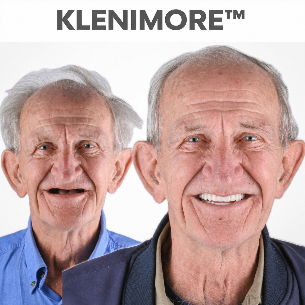 ⏰ Custom-Fit Dentures  ENDS TODAY   50% OFF | Smile with Confidence|Buy 2, Get 1 Free